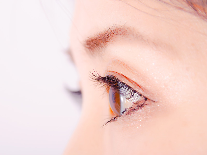 逆さまつ毛の電気分解治療